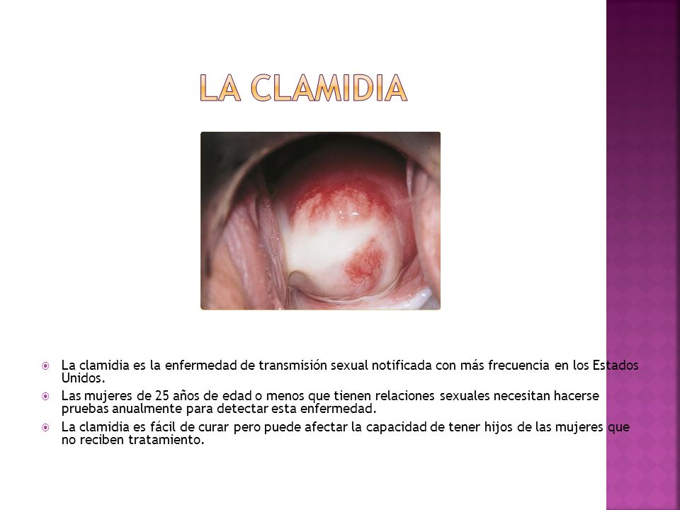 LA CLAMIDIA La clamidia es la enfermedad de transmisión sexual notificada con más frecuencia en los Estados Unidos.