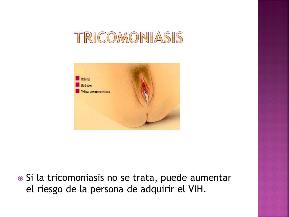 TRICOMONIASIS Si la tricomoniasis no se trata, puede aumentar el riesgo de la persona de adquirir el VIH.