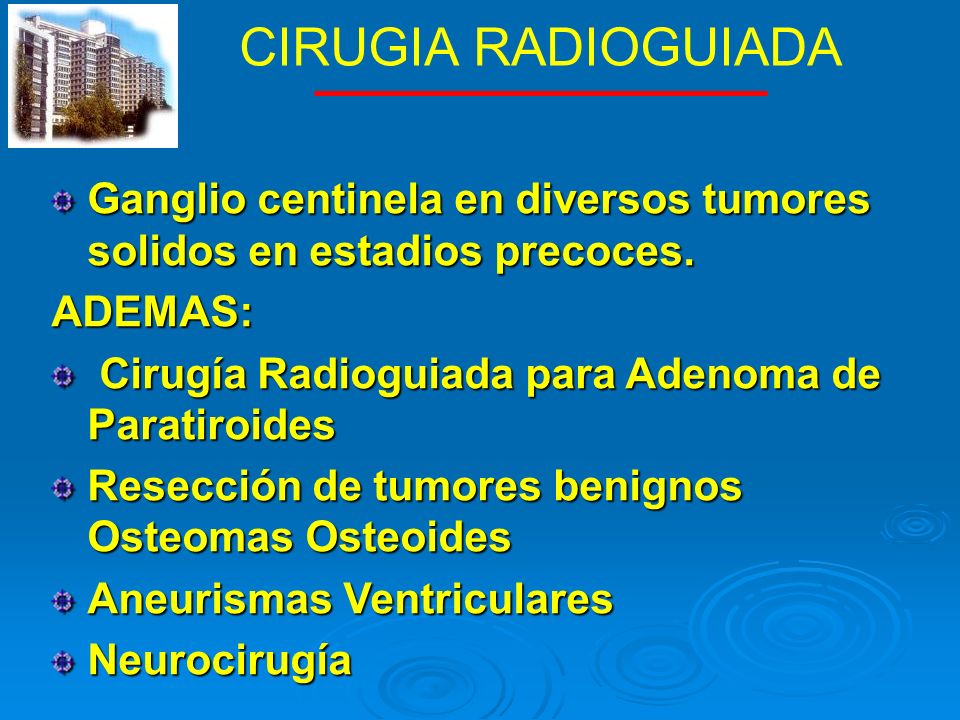 CIRUGIA RADIOGUIADA Ganglio centinela en diversos tumores solidos en estadios precoces. ADEMAS: Cirugía Radioguiada para Adenoma de Paratiroides.