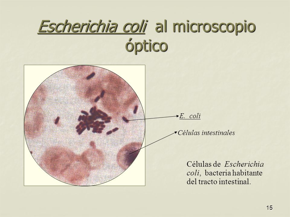 Escherichia coli al microscopio óptico