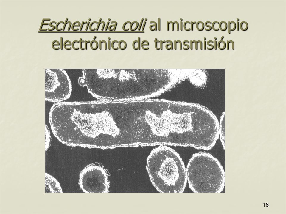 Escherichia coli al microscopio electrónico de transmisión
