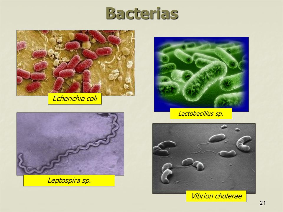 Bacterias Echerichia coli Leptospira sp. Vibrion cholerae
