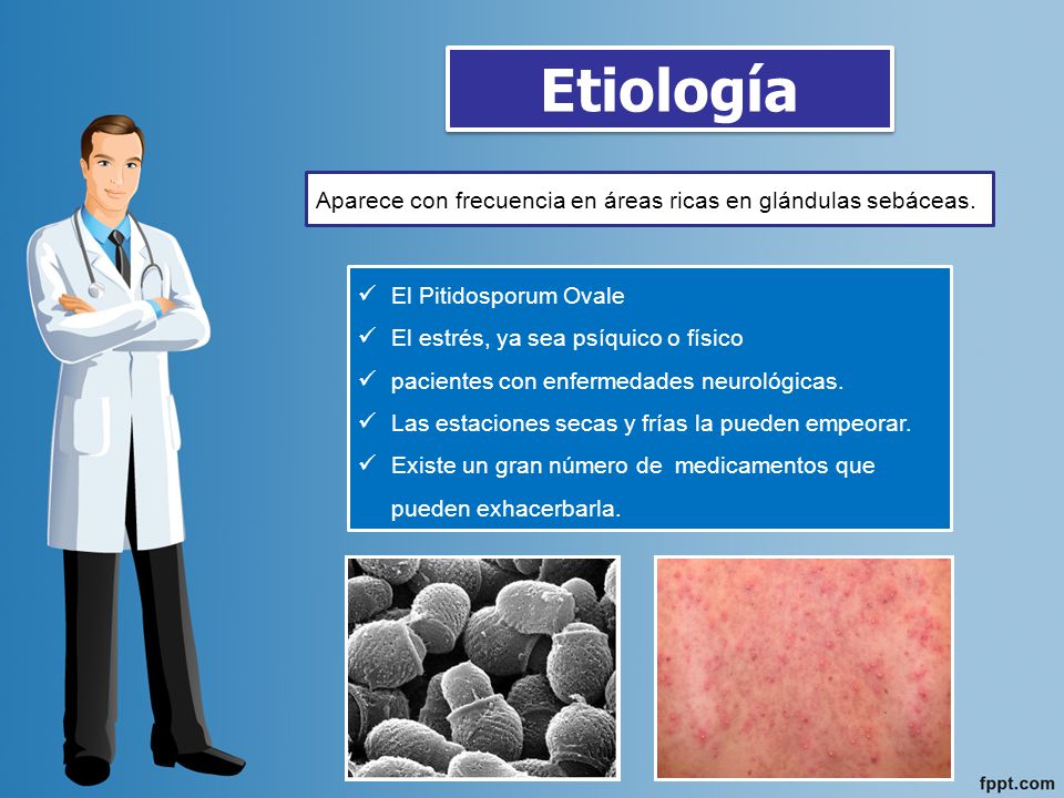 Etiología Aparece con frecuencia en áreas ricas en glándulas sebáceas.