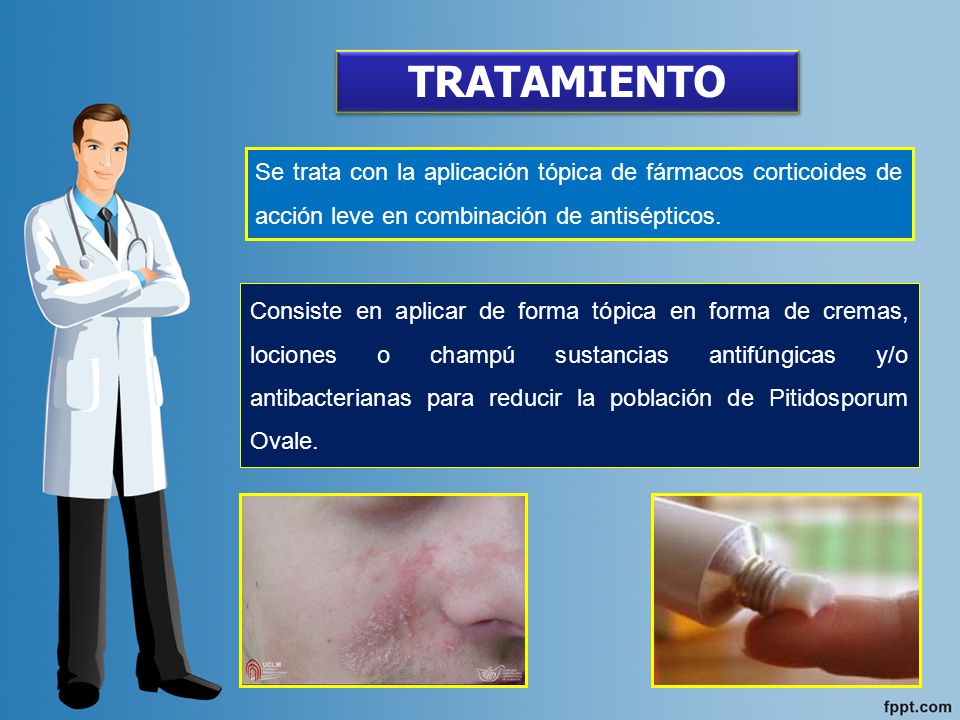 TRATAMIENTO Se trata con la aplicación tópica de fármacos corticoides de acción leve en combinación de antisépticos.