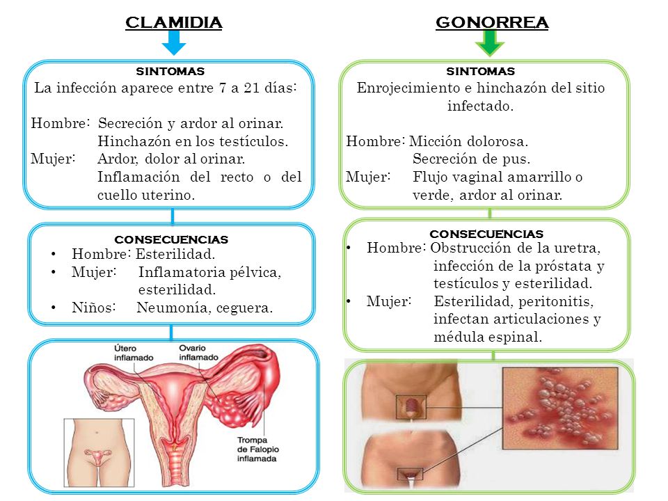 CLAMIDIA GONORREA La infección aparece entre 7 a 21 días:
