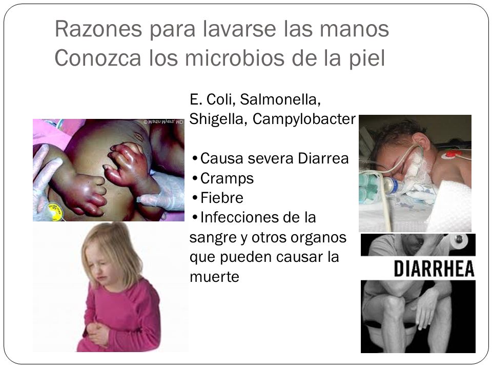 Razones para lavarse las manos Conozca los microbios de la piel