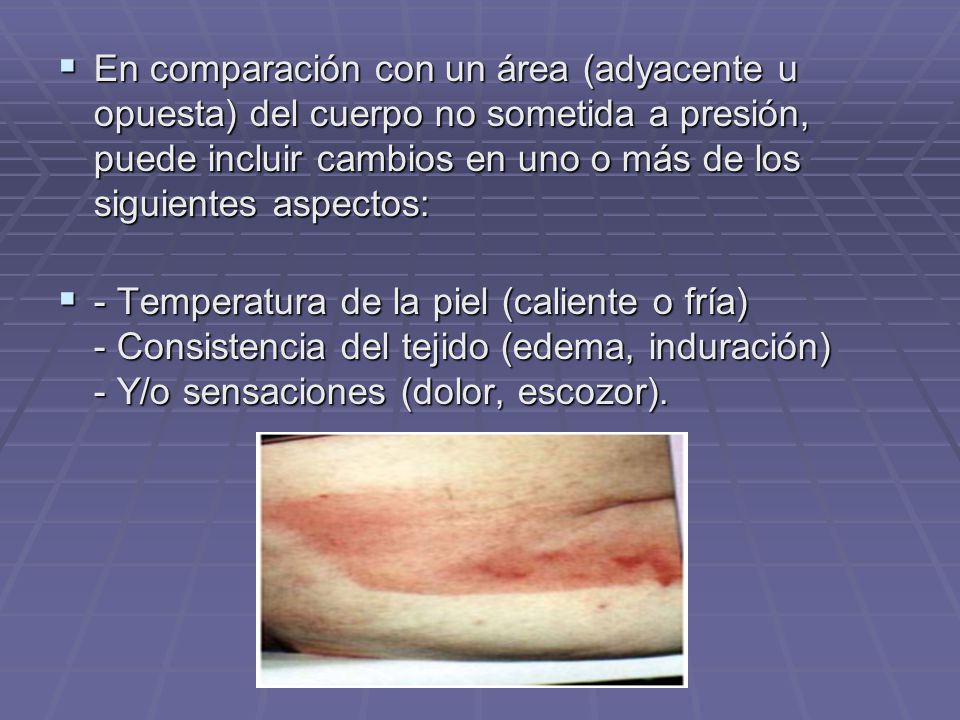 En comparación con un área (adyacente u opuesta) del cuerpo no sometida a presión, puede incluir cambios en uno o más de los siguientes aspectos: