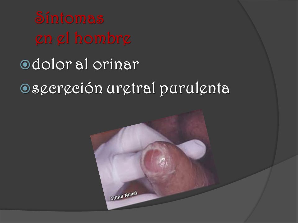 Síntomas en el hombre dolor al orinar secreción uretral purulenta