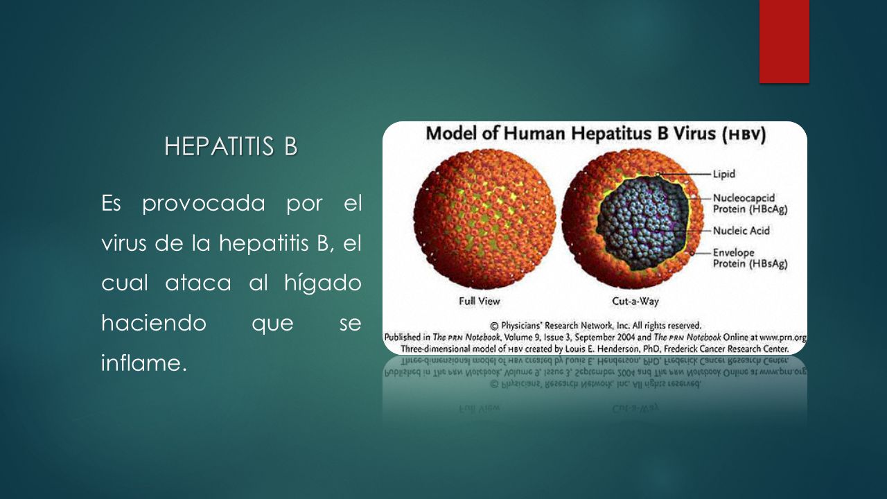 HEPATITIS B Es provocada por el virus de la hepatitis B, el cual ataca al hígado haciendo que se inflame.