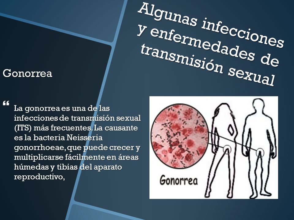 Algunas infecciones y enfermedades de transmisión sexual