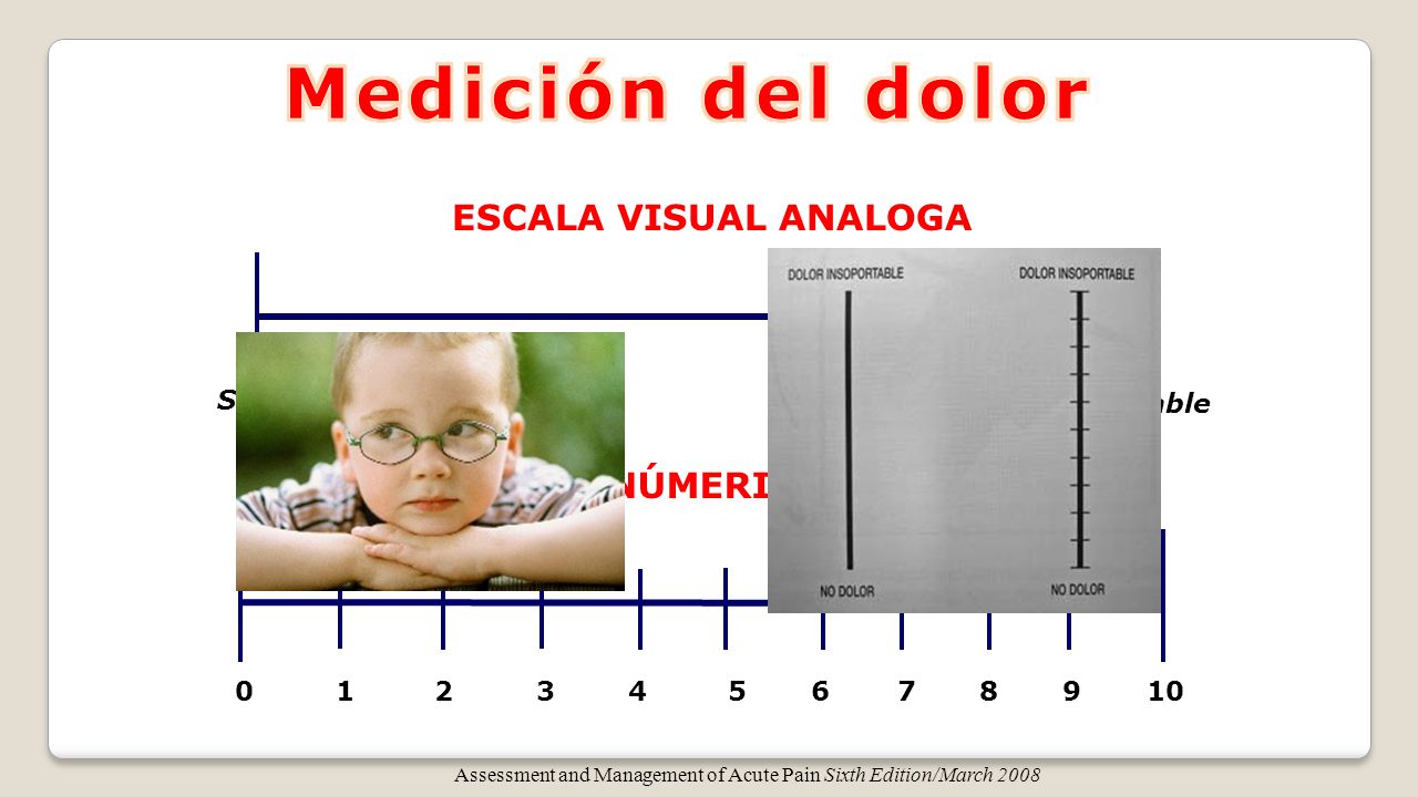 Medición del dolor ESCALA VISUAL ANALOGA ESCALA NÚMERICA ANALOGA