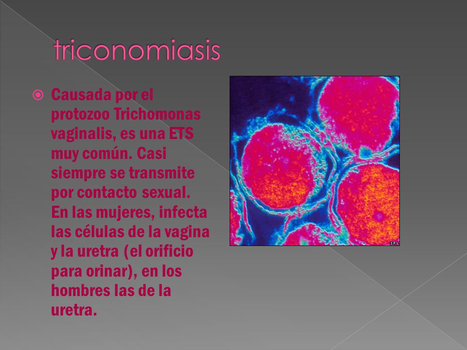 triconomiasis