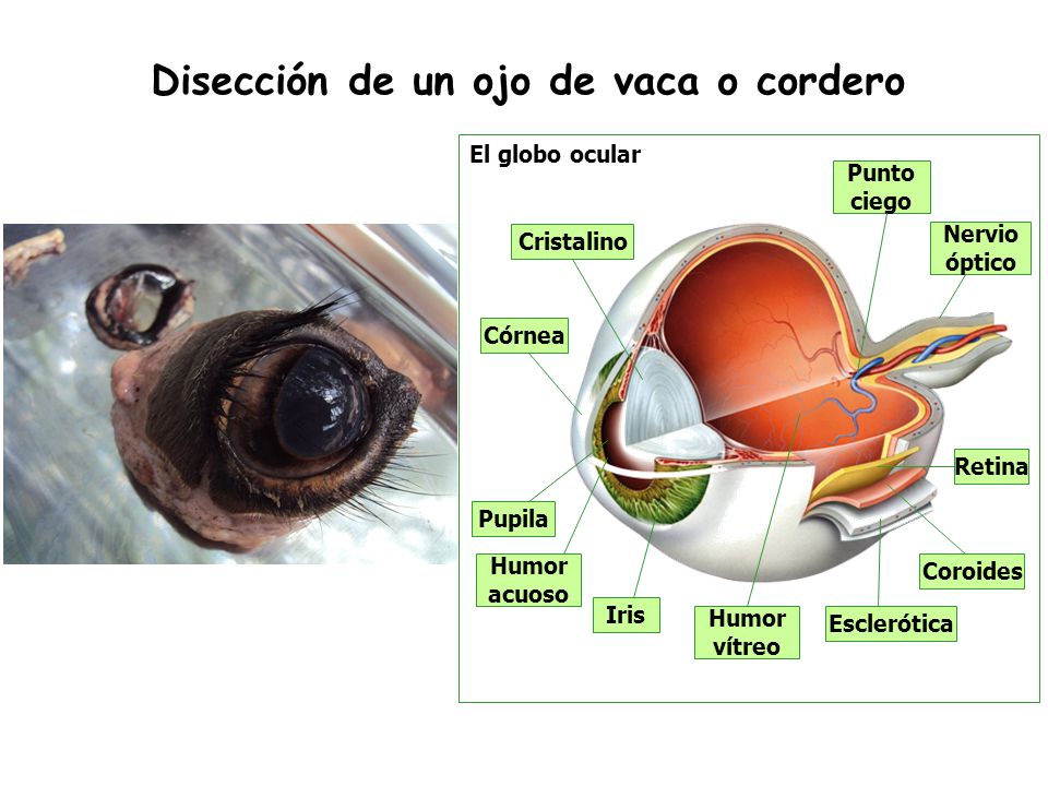 Desprendimiento De Retina