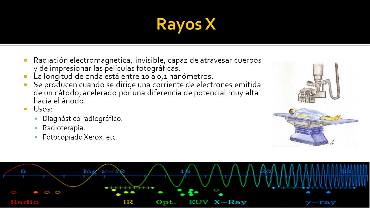 Rayos X Radiación electromagnética, invisible, capaz de atravesar cuerpos y de impresionar las películas fotográficas.