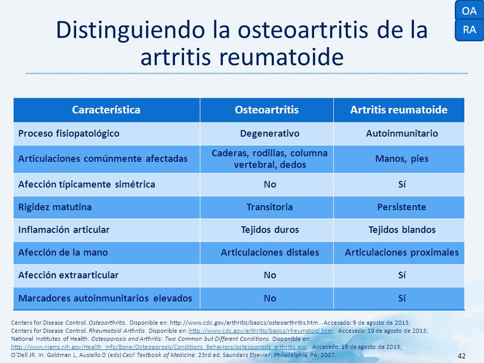 Distinguiendo la osteoartritis de la artritis reumatoide