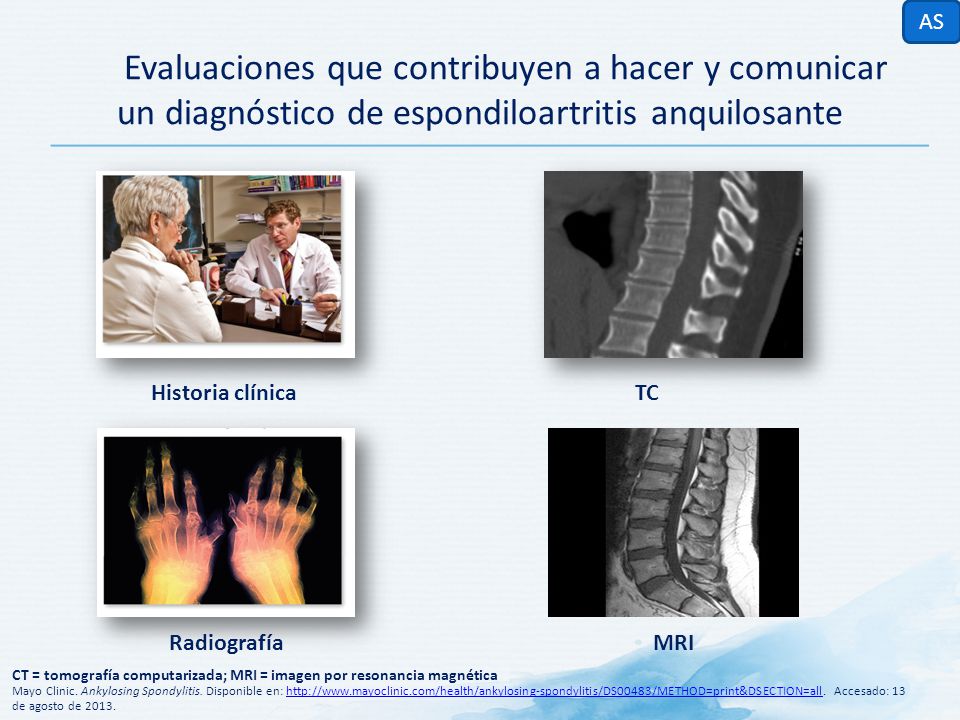 AS Evaluaciones que contribuyen a hacer y comunicar un diagnóstico de espondiloartritis anquilosante.