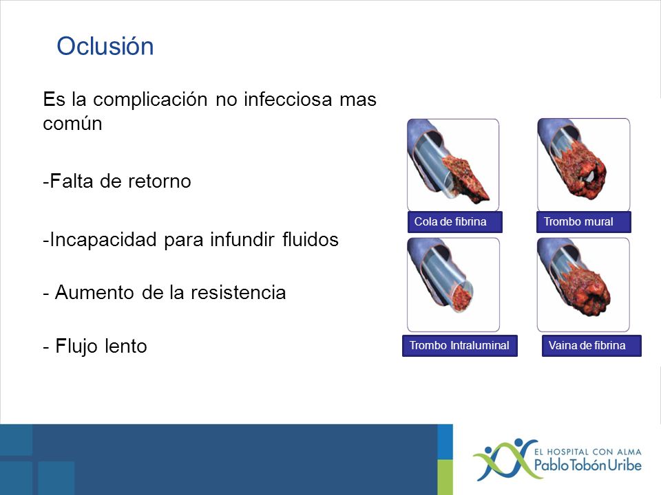 Oclusión Es la complicación no infecciosa mas común Falta de retorno
