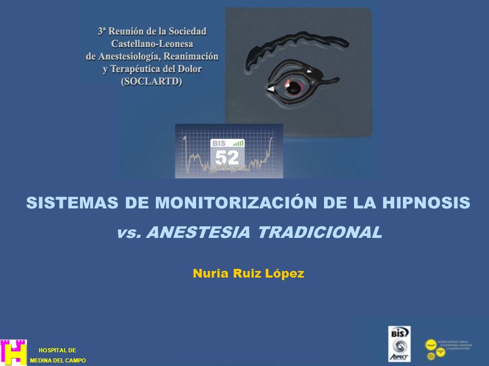 SISTEMAS DE MONITORIZACIÓN DE LA HIPNOSIS