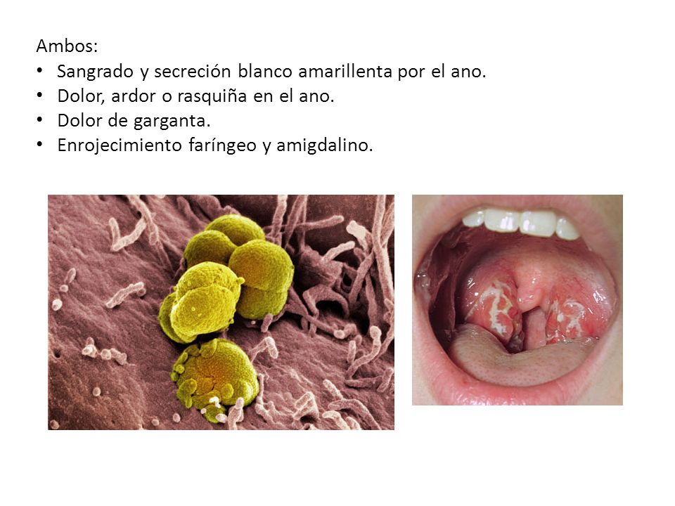 Ambos: Sangrado y secreción blanco amarillenta por el ano. Dolor, ardor o rasquiña en el ano. Dolor de garganta.