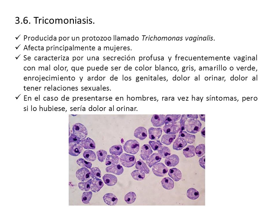 3.6. Tricomoniasis. Producida por un protozoo llamado Trichomonas vaginalis. Afecta principalmente a mujeres.