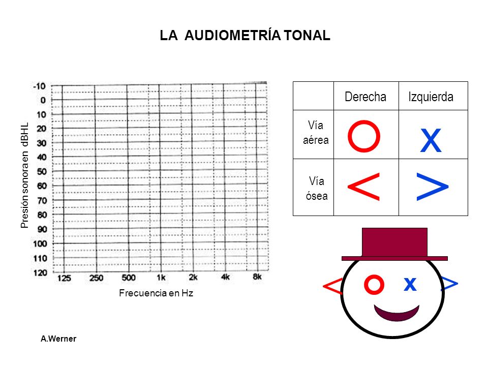 < > x < > x LA AUDIOMETRÍA TONAL Derecha Izquierda Vía