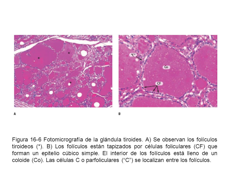 Figura 16-6 Fotomicrografía de la glándula tiroides