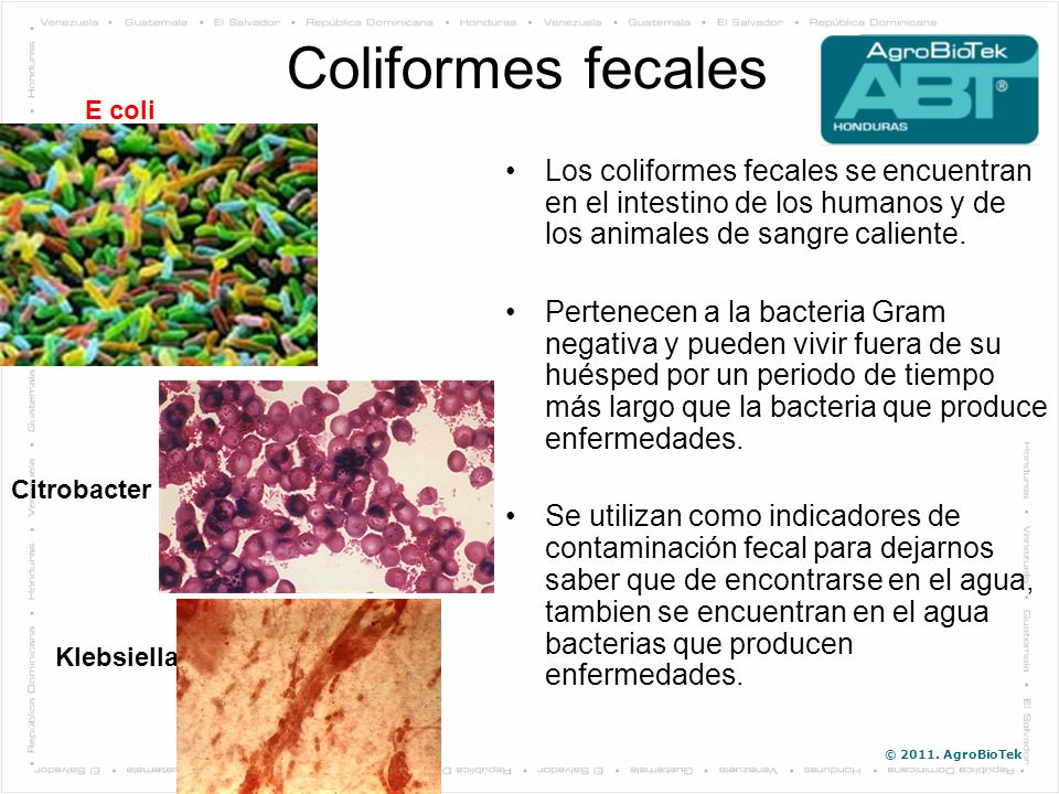 Coliformes fecales E coli. Los coliformes fecales se encuentran en el intestino de los humanos y de los animales de sangre caliente.