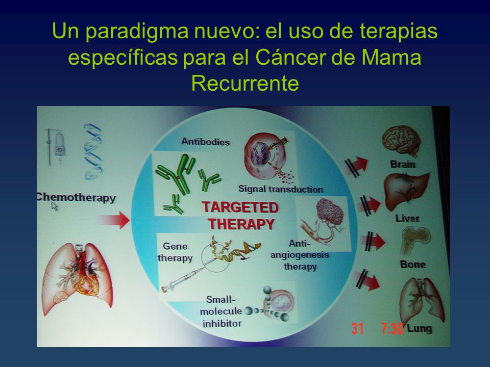Un paradigma nuevo: el uso de terapias específicas para el Cáncer de Mama Recurrente
