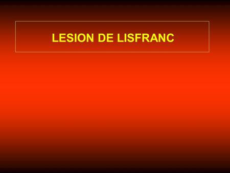 LESION DE LISFRANC.