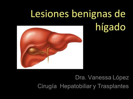 Lesiones benignas de hígado