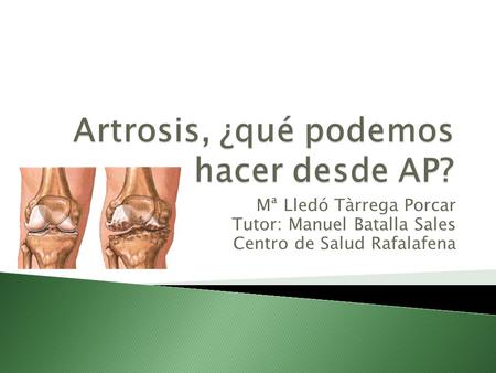 Artrosis, ¿qué podemos hacer desde AP?