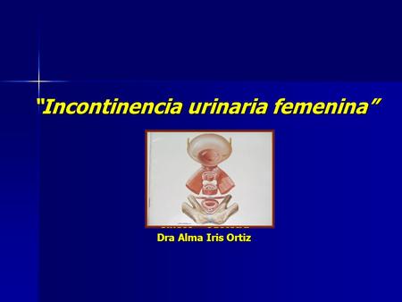 “Incontinencia urinaria femenina”