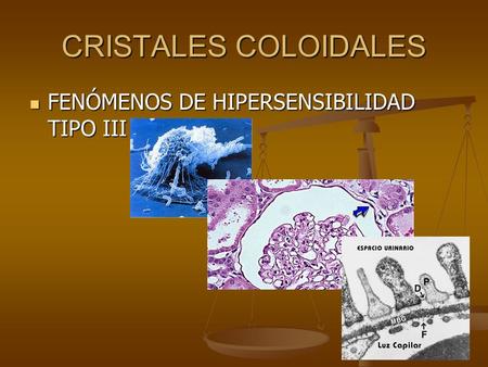 CRISTALES COLOIDALES FENÓMENOS DE HIPERSENSIBILIDAD TIPO III.