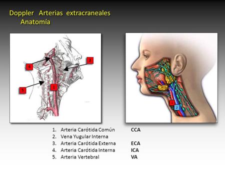 Doppler Arterias extracraneales Anatomía