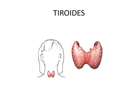 TIROIDES.
