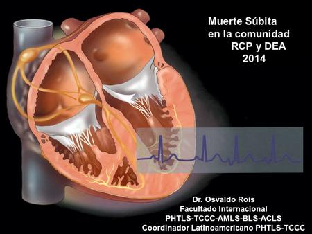 Muerte Súbita en la comunidad RCP y DEA 2014