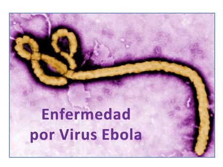 Enfermedad por Virus Ebola.