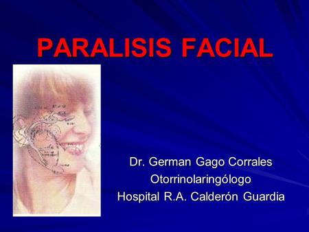 PARALISIS FACIAL Dr. German Gago Corrales Otorrinolaringólogo