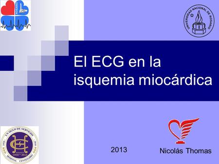 El ECG en la isquemia miocárdica