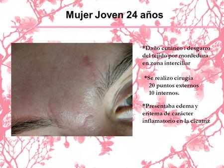 Mujer Joven 24 años *Daño cutáneo : desgarro del tejido por mordedura en zona interciliar *Se realizo cirugía 20 puntos externos 10 internos. *Presentaba.