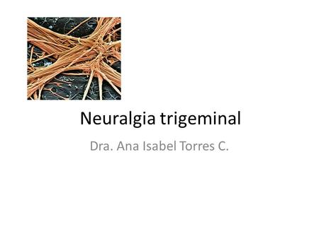 Neuralgia trigeminal Dra. Ana Isabel Torres C..