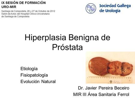 Hiperplasia Benigna de Próstata