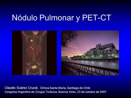 Nódulo Pulmonar y PET-CT