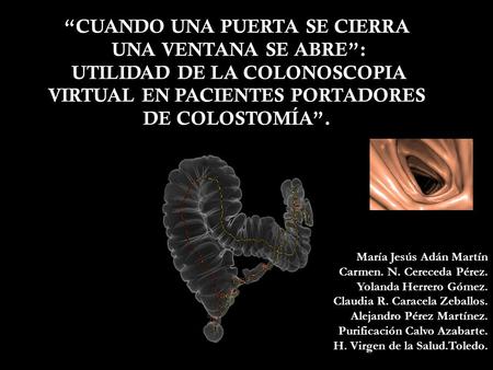 “CUANDO UNA PUERTA SE CIERRA UNA VENTANA SE ABRE”: UTILIDAD DE LA COLONOSCOPIA VIRTUAL EN PACIENTES PORTADORES DE COLOSTOMÍA”. María Jesús Adán Martín.