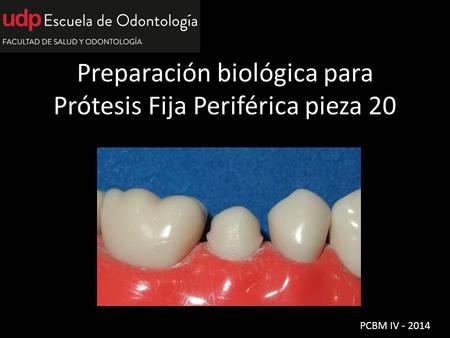 Preparación biológica para Prótesis Fija Periférica pieza 20 PCBM IV - 2014.