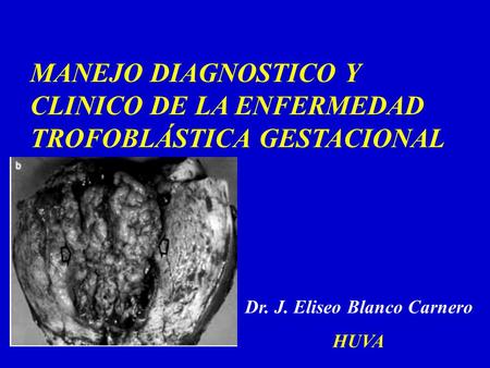 Dr. J. Eliseo Blanco Carnero