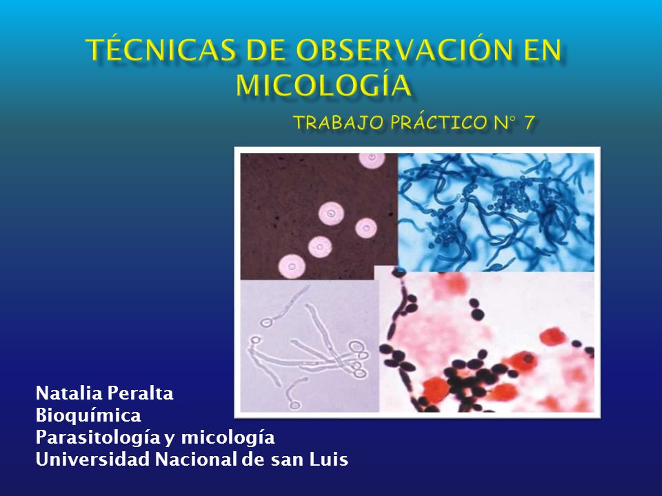 Técnicas de observación en micología - ppt video online descargar