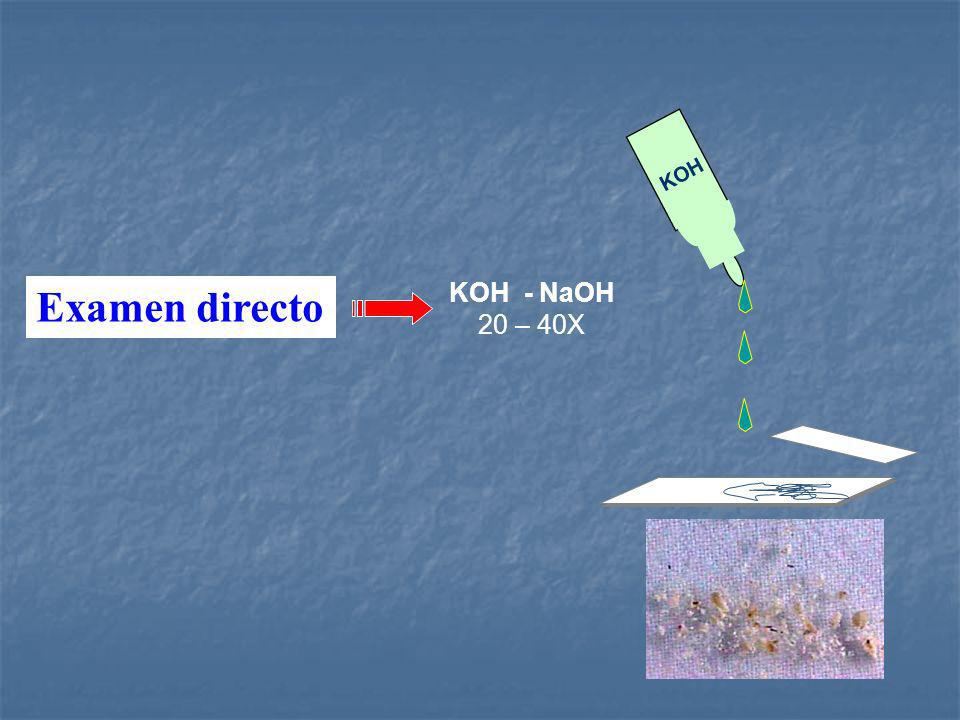 KOH Examen directo KOH - NaOH 20 – 40X. - ppt descargar