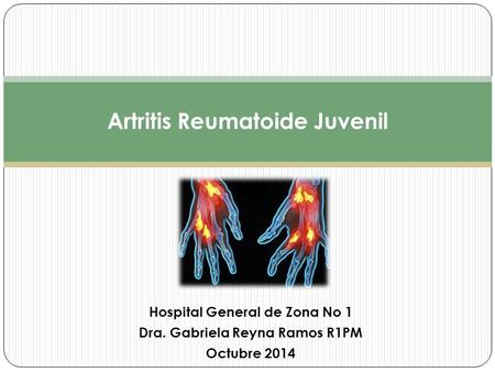 Artritis Reumatoide Juvenil