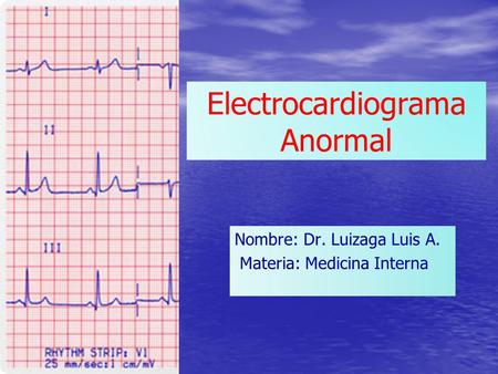 Electrocardiograma Anormal